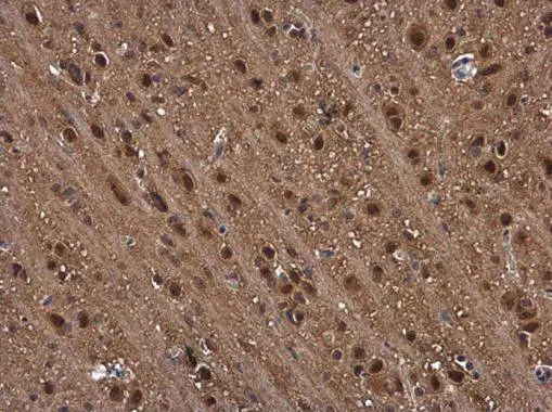 PSMB1 antibody detects PSMB1 protein at cytoplasm and nucleus in rat brain by immunohistochemical analysis. Sample: Paraffin-embedded rat brain. PSMB1 antibody (GTX130875) diluted at 1:500.
Antigen Retrieval: Citrate buffer, pH 6.0, 15 min PSMB1 antibody detects PSMB1 protein at cytoplasm and nucleus in rat brain by immunohistochemical analysis. Sample: Paraffin-embedded rat brain. PSMB1 antibody (GTX130875) diluted at 1:500.
Antigen Retrieval: Citrate buffer, pH 6.0, 15 min
