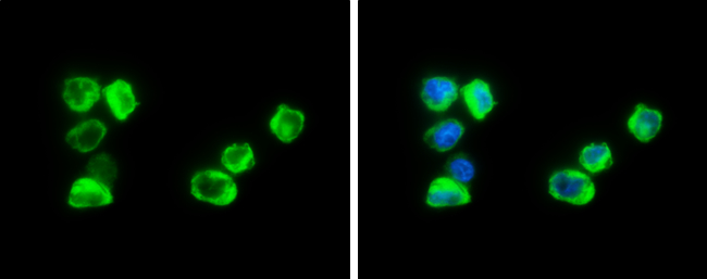 Cystatin A antibody detects Cystatin A protein at cytoplasm by immunofluorescent analysis. Sample: THP-1 cells were fixed in 4% paraformaldehyde at RT for 15 min. Green: Cystatin A stained by Cystatin A antibody (GTX130885) diluted at 1:500. Blue: Fluoroshield with DAPI (GTX30920).
