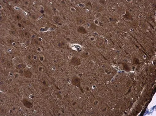 PYK2 antibody detects PYK2 protein at cytoplasm and nucleus in rat brain by immunohistochemical analysis. Sample: Paraffin-embedded rat brain. PYK2 antibody (GTX130887) diluted at 1:500. 
 Antigen Retrieval: Citrate buffer, pH 6.0, 15 min
