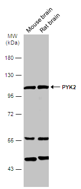 Various tissue extracts (50 μg) were separated by 7.5% SDS-PAGE, and the membrane was blotted with PYK2 antibody (GTX130887) diluted at 1:1000. The HRP-conjugated anti-rabbit IgG antibody (GTX213110-01) was used to detect the primary antibody.