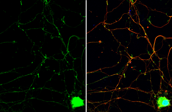 PYK2 antibody detects PYK2 protein by immunofluorescent analysis. Sample: DIV9 rat E18 primary hippocampal neuron cells were fixed in 4% paraformaldehyde at RT for 15 min. Green: PYK2 stained by PYK2 antibody (GTX130887) diluted at 1:500. Red: beta Tubulin 3/ Tuj1, stained by beta Tubulin 3/ Tuj1 antibody [GT11710] (GTX631836) diluted at 1:500. Blue: Fluoroshield with DAPI (GTX30920).