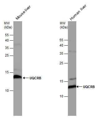 UQCRB antibody detects UQCRB protein by western blot analysis. Human tissue extracts (30 μg) and mouse tissue extracts (50 μg) were separated by 15% SDS-PAGE, and the membrane was blotted with UQCRB antibody (GTX130895) diluted at 1:5000.