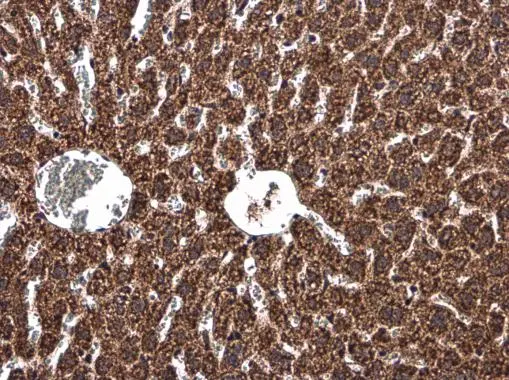 UQCRB antibody detects UQCRB protein at mitochondria in mouse liver by immunohistochemical analysis. Sample: Paraffin-embedded mouse liver. UQCRB antibody (GTX130895) diluted at 1:500. 
 Antigen Retrieval: Citrate buffer, pH 6.0, 15 min