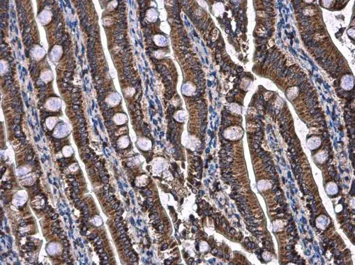 UQCRB antibody detects UQCRB protein at mitochondria in rat intestine by immunohistochemical analysis. Sample: Paraffin-embedded rat intestine. UQCRB antibody (GTX130895) diluted at 1:500. 
 Antigen Retrieval: Citrate buffer, pH 6.0, 15 min
