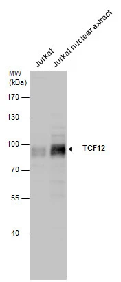 TCF12 antibody detects TCF12 protein by western blot analysis. Jurkat whole cell extracts and nuclear extracts (30 μg) were separated by 7.5% SDS-PAGE, and the membrane was blotted with TCF12 antibody (GTX130901) diluted at 1:1000.