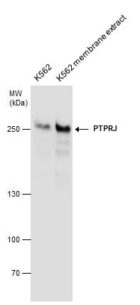 PTPRJ antibody detects PTPRJ protein by western blot analysis. K562 whole cell extracts and membrane extracts (30 μg) were separated by 5% SDS-PAGE, and the membrane was blotted with PTPRJ antibody (GTX130904) diluted at 1:1000.