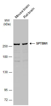 Various tissue extracts (50 μg) were separated by 5% SDS-PAGE, and the membrane was blotted with SPTBN1 antibody (GTX130935) diluted at 1:5000. The HRP-conjugated anti-rabbit IgG antibody (GTX213110-01) was used to detect the primary antibody.