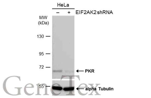 Non-transfected (–) and transfected (+) HeLa whole cell extracts (50 μg) were separated by 7.5% SDS-PAGE, and the membrane was blotted with PKR antibody (GTX130941) diluted at 1:5000. The HRP-conjugated anti-rabbit IgG antibody (GTX213110-01) was used to detect the primary antibody, and the signal was developed with Trident ECL plus-Enhanced.