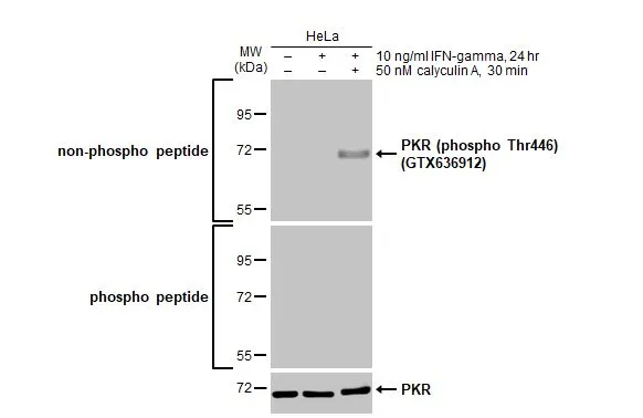 Untreated (–) and treated (+) HeLa whole cell extracts (30 μg) were separated by 7.5% SDS-PAGE, and the membrane was blotted with PKR antibody (GTX130941) diluted at 1:1000. The HRP-conjugated anti-rabbit IgG antibody (GTX213110-01) was used to detect the primary antibody, and the signal was developed with Trident ECL plus-Enhanced.