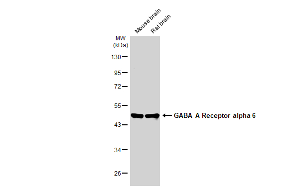 Various tissue extracts (50 μg) were separated by 10% SDS-PAGE, and the membrane was blotted with GABA A Receptor alpha 6 antibody (GTX130947) diluted at 1:1000. The HRP-conjugated anti-rabbit IgG antibody (GTX213110-01) was used to detect the primary antibody. Various tissue extracts (50 μg) were separated by 10% SDS-PAGE, and the membrane was blotted with GABA A Receptor alpha 6 antibody (GTX130947) diluted at 1:1000. The HRP-conjugated anti-rabbit IgG antibody (GTX213110-01) was used to detect the primary antibody.