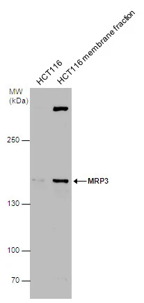 MRP3 antibody detects MRP3 protein by western blot analysis. HCT116 whole cell extracts and membrane extracts (30 μg) were separated by 5% SDS-PAGE, and the membrane was blotted with MRP3 antibody (GTX130948) diluted at 1:500.
