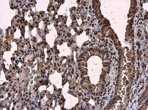 SRSF2 antibody detects SRSF2 protein at nucleus in mouse lung by immunohistochemical analysis. Sample: Paraffin-embedded mouse lung. SRSF2 antibody (GTX130950) diluted at 1:500. 
 Antigen Retrieval: Citrate buffer, pH 6.0, 15 min