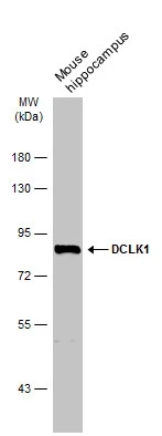 Mouse tissue extract (50 μg) was separated by 7.5% SDS-PAGE, and the membrane was blotted with DCLK1 antibody (GTX130959) diluted at 1:5000. The HRP-conjugated anti-rabbit IgG antibody (GTX213110-01) was used to detect the primary antibody.