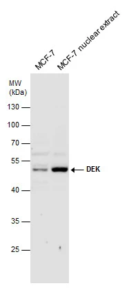DEK antibody detects DEK protein by western blot analysis. MCF-7 whole cell extracts and nuclear extracts (30 μg) were separated by 10% SDS-PAGE, and the membrane was blotted with DEK antibody (GTX130963) diluted at 1:1000.