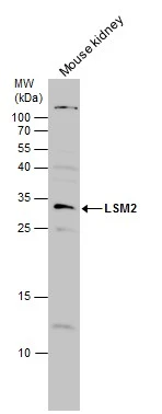 Mouse tissue extract (50 μg) was separated by 15% SDS-PAGE, and the membrane was blotted with LSM2 antibody (GTX130964) diluted at 1:500.