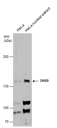 DHX9 antibody detects DHX9 protein by western blot analysis. HeLa whole cell extracts and nuclear extracts (30 μg) were separated by 5% SDS-PAGE, and the membrane was blotted with DHX9 antibody (GTX130971) diluted at 1:1000.