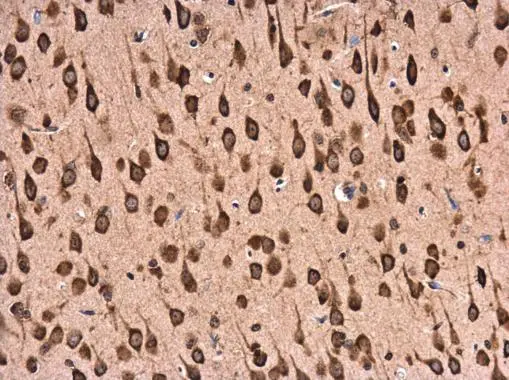 RPL22 antibody detects RPL22 protein at cytoplasm in rat brain by immunohistochemical analysis. Sample: Paraffin-embedded rat brain. RPL22 antibody (GTX130972) diluted at 1:500.
Antigen Retrieval: Citrate buffer, pH 6.0, 15 min