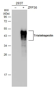 Non-transfected (–) and transfected (+) 293T whole cell extracts (30 μg) were separated by 12% SDS-PAGE, and the membrane was blotted with Tristetraprolin antibody (GTX130974) diluted at 1:5000. The HRP-conjugated anti-rabbit IgG antibody (GTX213110-01) was used to detect the primary antibody, and the signal was developed with Trident ECL plus-Enhanced. Non-transfected (–) and transfected (+) 293T whole cell extracts (30 μg) were separated by 12% SDS-PAGE, and the membrane was blotted with Tristetraprolin antibody (GTX130974) diluted at 1:5000. The HRP-conjugated anti-rabbit IgG antibody (GTX213110-01) was used to detect the primary antibody, and the signal was developed with Trident ECL plus-Enhanced.