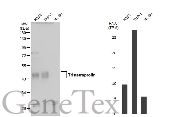 Various whole cell extracts (30 μg) were separated by 10% SDS-PAGE, and the membrane was blotted with Tristetraprolin antibody (GTX130974) diluted at 1:500. The HRP-conjugated anti-rabbit IgG antibody (GTX213110-01) was used to detect the primary antibody. Corresponding RNA expression data for the same cell lines are based on Human Protein Atlas program. Various whole cell extracts (30 μg) were separated by 10% SDS-PAGE, and the membrane was blotted with Tristetraprolin antibody (GTX130974) diluted at 1:500. The HRP-conjugated anti-rabbit IgG antibody (GTX213110-01) was used to detect the primary antibody. Corresponding RNA expression data for the same cell lines are based on Human Protein Atlas program.