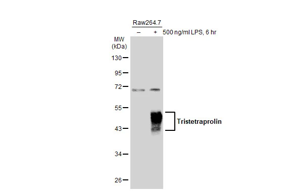 Untreated (–) and treated (+) Raw264.7 whole cell extracts (30 μg) were separated by 10% SDS-PAGE, and the membrane was blotted with Tristetraprolin antibody (GTX130974) diluted at 1:500. The HRP-conjugated anti-rabbit IgG antibody (GTX213110-01) was used to detect the primary antibody.