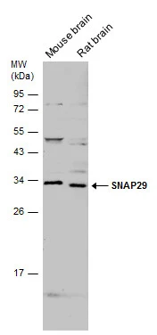 Various tissue extracts (50 μg) were separated by 12% SDS-PAGE, and the membrane was blotted with SNAP29 antibody (GTX131028) diluted at 1:500.