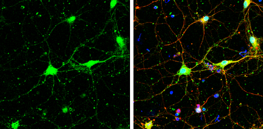 SNAP29 antibody detects SNAP29 protein at cell body and synaptic vesicles by immunofluorescent analysis. Sample: DIV9 rat E18 primary cortical neurons were fixed in 4% paraformaldehyde at RT for 15 min. Green: SNAP29 protein stained by SNAP29 antibody (GTX131028) diluted at 1:500. Red: beta Tubulin 3/ Tuj1, a neuron cell marker, stained by beta Tubulin 3/ Tuj1 antibody [GT11710] (GTX631836) diluted at 1:500. Blue: Fluoroshield with DAPI (GTX30920).