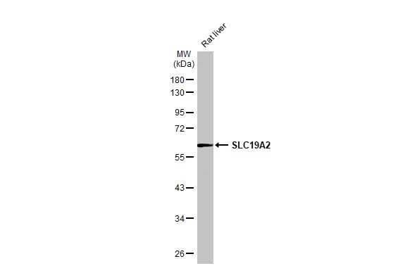 Rat tissue extract (50 μg) was separated by 10% SDS-PAGE, and the membrane was blotted with SLC19A2 antibody (GTX131042) diluted at 1:1000. The HRP-conjugated anti-rabbit IgG antibody (GTX213110-01) was used to detect the primary antibody.