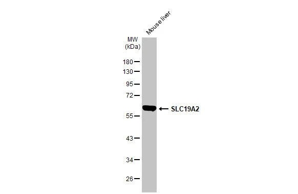 Mouse tissue extract (50 μg) was separated by 10% SDS-PAGE, and the membrane was blotted with SLC19A2 antibody (GTX131042) diluted at 1:2500. The HRP-conjugated anti-rabbit IgG antibody (GTX213110-01) was used to detect the primary antibody. Mouse tissue extract (50 μg) was separated by 10% SDS-PAGE, and the membrane was blotted with SLC19A2 antibody (GTX131042) diluted at 1:2500. The HRP-conjugated anti-rabbit IgG antibody (GTX213110-01) was used to detect the primary antibody.