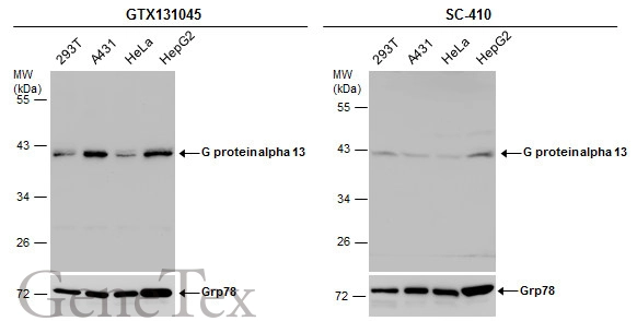 Various whole cell extracts (30 μg) were separated by 10% SDS-PAGE, and the membranes were blotted with G protein alpha 13 antibody (GTX131045) diluted at 1:1000 and competitor's antibody (SC-410) diluted by 1:50.