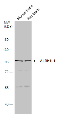 Various tissue extracts (50 μg) were separated by 7.5% SDS-PAGE, and the membrane was blotted with ALDH1L1 antibody (GTX131047) diluted at 1:500. The HRP-conjugated anti-rabbit IgG antibody (GTX213110-01) was used to detect the primary antibody.