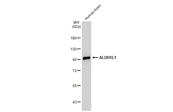 Human tissue extract (30 μg) was separated by 7.5% SDS-PAGE, and the membrane was blotted with ALDH1L1 antibody (GTX131047) diluted at 1:1000. The HRP-conjugated anti-rabbit IgG antibody (GTX213110-01) was used to detect the primary antibody.