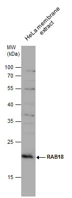 HeLa membrane extract (30 μg) was separated by 12% SDS-PAGE, and the membrane was blotted with RAB18 antibody (GTX131055) diluted at 1:1000.