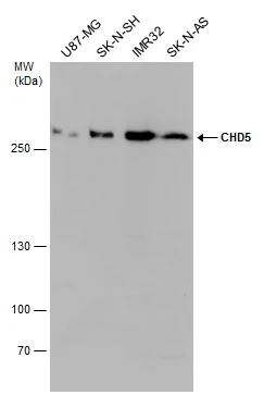 Various whole cell extracts (30 μg) were separated by 5% SDS-PAGE, and the membrane was blotted with CHD5 antibody (GTX131065) diluted at 1:1000.
