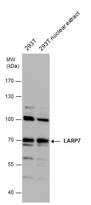 LARP7 antibody detects LARP7 protein by western blot analysis. 293T whole cell extracts and nuclear extracts (30 μg) were separated by 7.5% SDS-PAGE, and the membrane was blotted with LARP7 antibody (GTX131082) diluted at 1:1000.