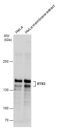 RTN3 antibody detects RTN3 protein by western blot analysis. HeLa whole cell extracts and membrane extracts (30 μg) were separated by 5% SDS-PAGE, and the membrane was blotted with RTN3 antibody (GTX131091) diluted at 1:500.