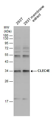 293T whole cell and membrane extracts (30 μg) were separated by 12% SDS-PAGE, and the membrane was blotted with CLEC4E antibody (GTX131096) diluted at 1:1000.