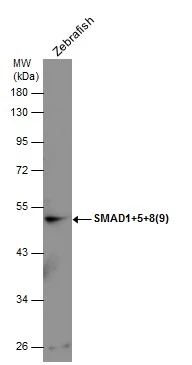 SMAD1+5+8(9) antibody