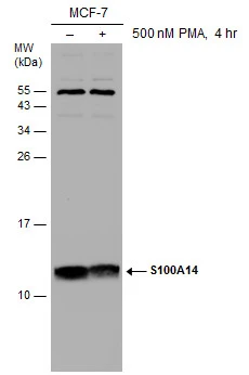 Untreated (–) and treated (+) MCF-7 whole cell extracts (30 μg) were separated by 15% SDS-PAGE, and the membrane was blotted with S100A14 antibody (GTX131119) diluted at 1:1000.
