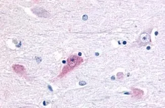 IHC-P analysis of human brain, thalamus tissue using GTX13113 ROR beta antibody. Antigen retrieval : Heat-induced antigen retrieval IHC-P analysis of human brain, thalamus tissue using GTX13113 ROR beta antibody. Antigen retrieval : Heat-induced antigen retrieval