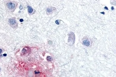 IHC-P analysis of brain, alzheimers disease, senile plaque tissue using GTX13113 ROR beta antibody.