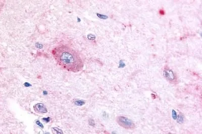 IHC-P analysis of brain, hypothalamus tissue using GTX13113 ROR beta antibody.
