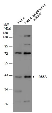 HeLa whole cell and cytoplasm extracts (30 μg) were separated by 10% SDS-PAGE, and the membrane was blotted with RBFA antibody (GTX131133) diluted at 1:1000.