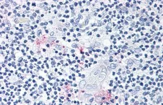 Immunohistochemical staining of human tissue sections using RORC antibody (GTX13116)
