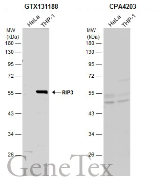 Various whole cell extracts (30 μg) were separated by 10% SDS-PAGE, and the membranes were blotted with RIP3 antibody (GTX131188) diluted at 1:1000 and competitor's antibody (CPA4203) diluted at 1:1000. The HRP-conjugated anti-rabbit IgG antibody (GTX213110-01) was used to detect the primary antibody. *The competitor is not affiliated with GeneTex and does not endorse this product.
