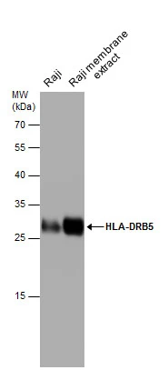 HLA-DRB5 antibody