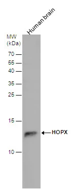 HOPX antibody detects HOPX protein by western blot analysis. Human tissue extracts (30 μg) was separated by 15% SDS-PAGE, and the membrane was blotted with HOPX antibody (GTX131224) diluted at 1:500.