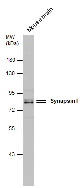 Mouse tissue extract (50 μg) was separated by 7.5% SDS-PAGE, and the membrane was blotted with Synapsin I antibody (GTX131233) diluted at 1:500.