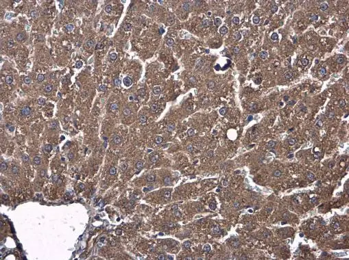 Usp13 antibody detects Usp13 protein at cytoplasm in rat liver by immunohistochemical analysis. Sample: Paraffin-embedded rat liver. Usp13 antibody (GTX131243) diluted at 1:500.
Antigen Retrieval: Citrate buffer, pH 6.0, 15 min