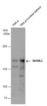 MAML2 antibody detects MAML2 protein by western blot analysis. HeLa whole cell extracts and nuclear extracts (30 μg) were separated by 5% SDS-PAGE, and the membrane was blotted with MAML2 antibody (GTX131250) diluted at 1:500.