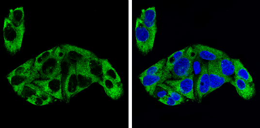 Alpha fetoprotein / AFP antibody detects Alpha fetoprotein / AFP protein by immunofluorescent analysis. Sample: HepG2 cells were fixed in 4% paraformaldehyde at RT for 15 min. Green: Alpha fetoprotein / AFP stained by Alpha fetoprotein / AFP antibody (GTX131311) diluted at 1:500. Blue: Hoechst 33342 staining.